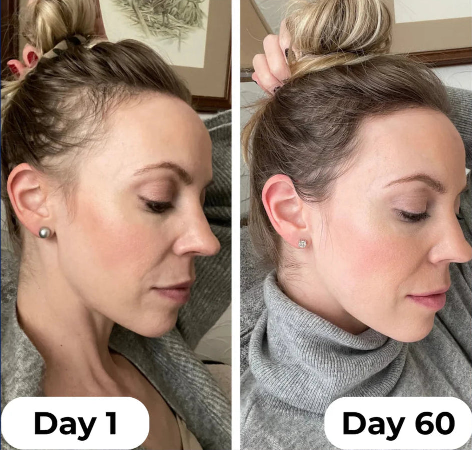 Hair Growth Serum