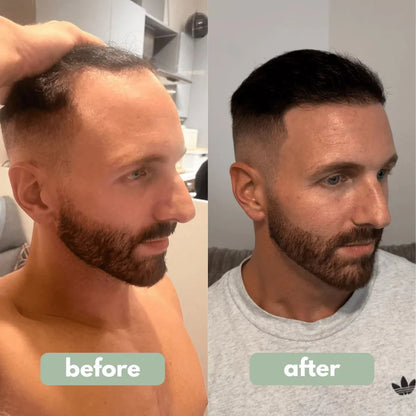 Hair Growth Serum